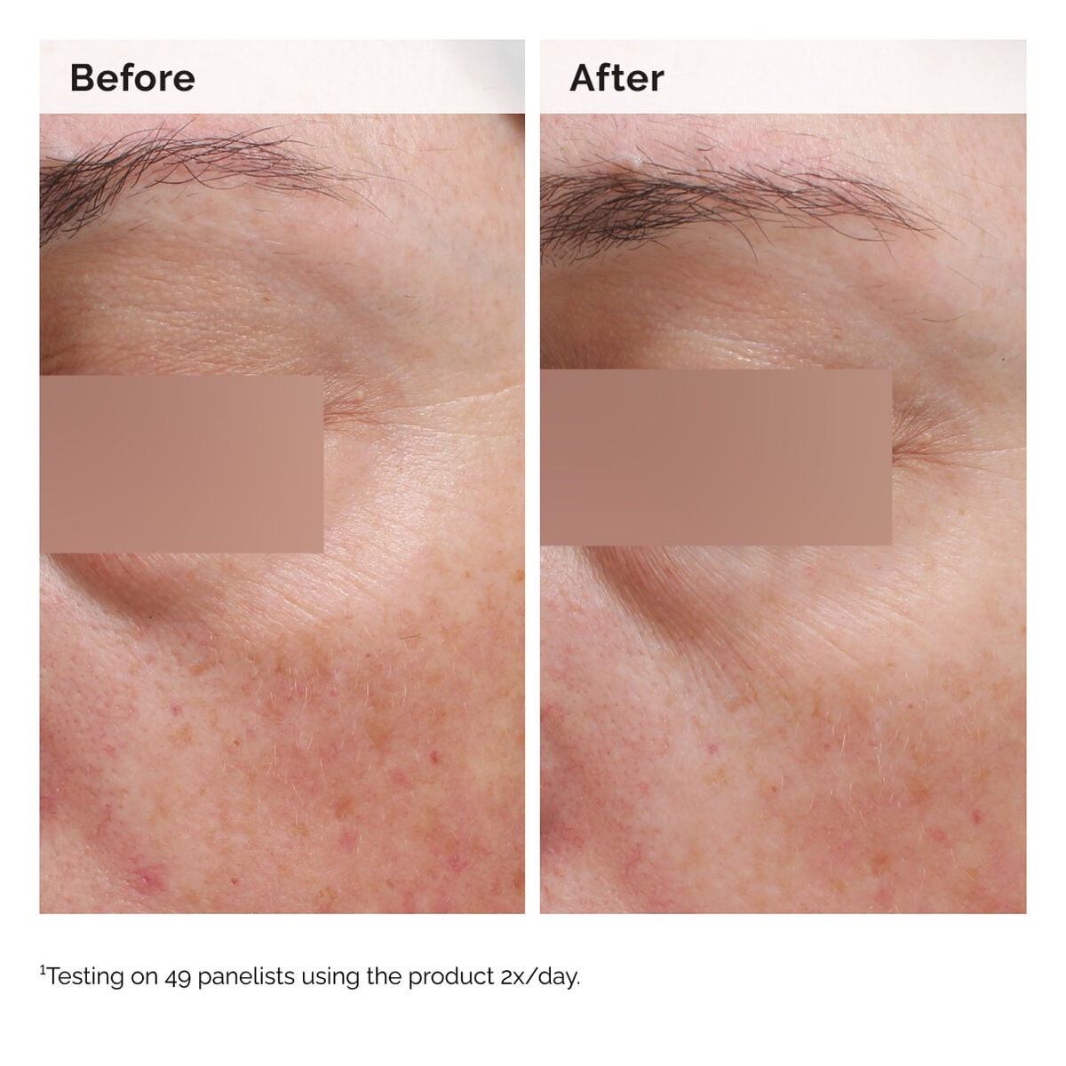 niacinamide-5-face-and-body-emulsion-w8 2024-08-23-ORD-Nia-5pct-Face-Body-B-A-Elasticity-Global-02-1x1.jpg