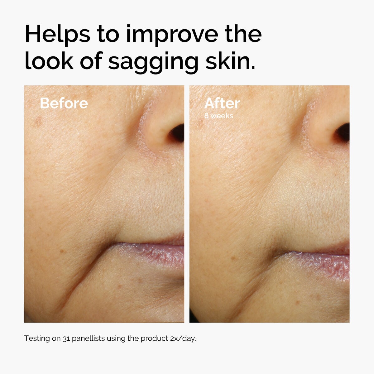 caffeine-3-escin-1-face-serum-u0 ord-caffeine-3pct-escin-1pct-face-serum-before-after-sagging.jpg