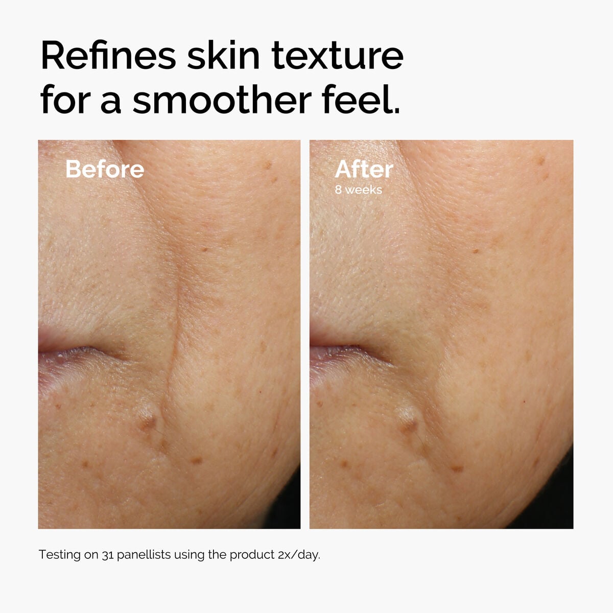 caffeine-3-escin-1-face-serum-u0 ord-caffeine-3pct-escin-1pct-face-serum-before-after-texture.jpg
