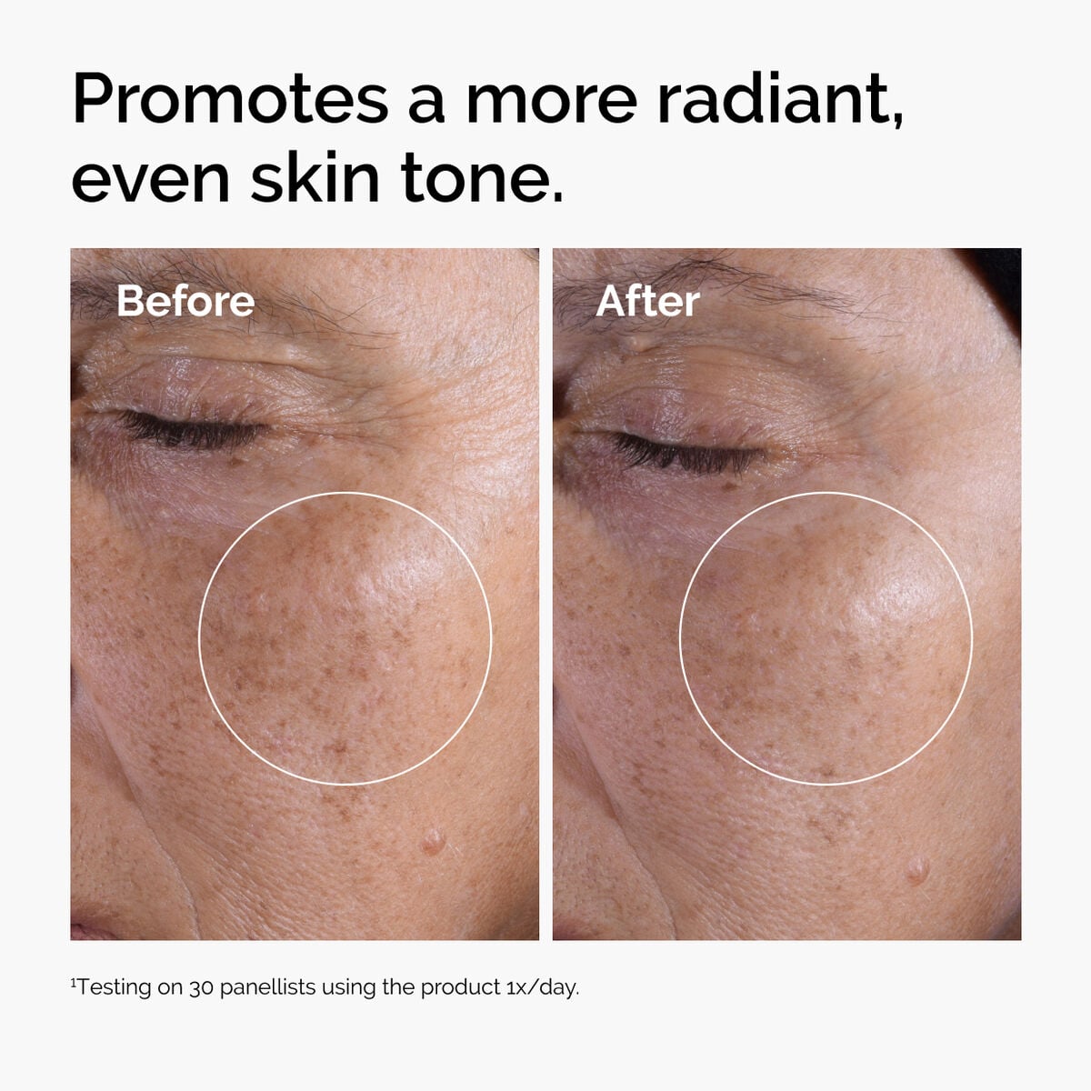glycolic-acid-7-exfoliating-toner-r0 ord-glycolic-before-after-radiance.jpg