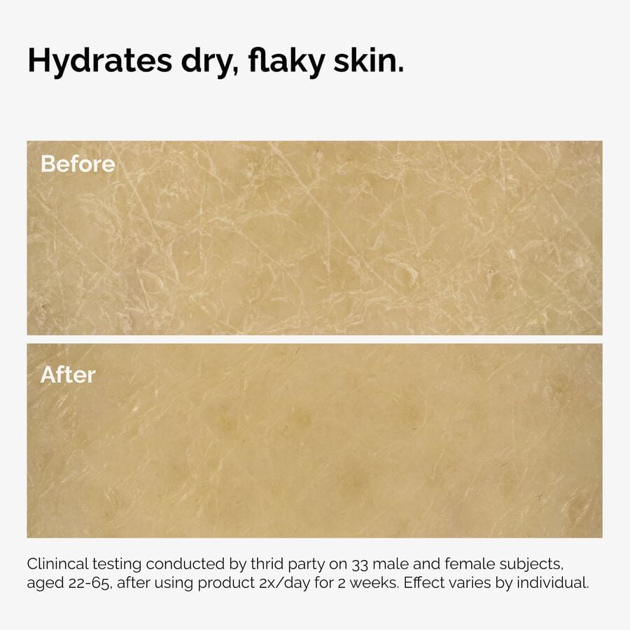 the-body-care-collection-k5 ord-natural-moisturizing-factors-inulin-body-before-after-graphic-02.jpg