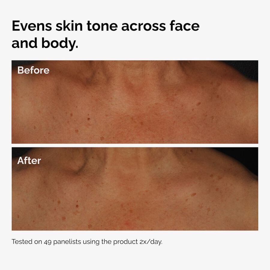 the-body-care-collection-k5 ord-niacinamide-face-body-serum-before-after-even-tone-graphic.jpg